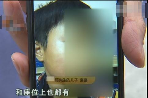 孩子校車上被打耳光，父親找到學校要說法，校長：老師心情不好